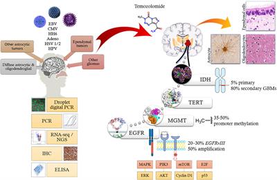 Epstein–Barr Virus in Gliomas: Cause, Association, or Artifact?